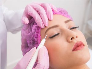mulher recendo jato de plasma na região da pálpebra fixa