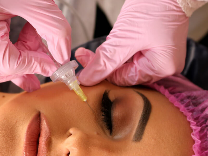 profissional aplicando carboxiterapia em rosto de paciente
