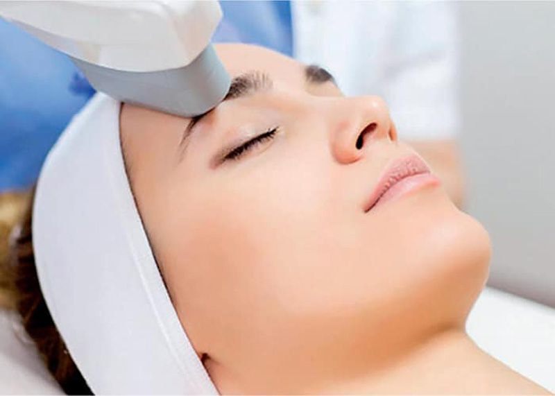 aplicação de ultrassom microfocado em rosto de paciente mulher