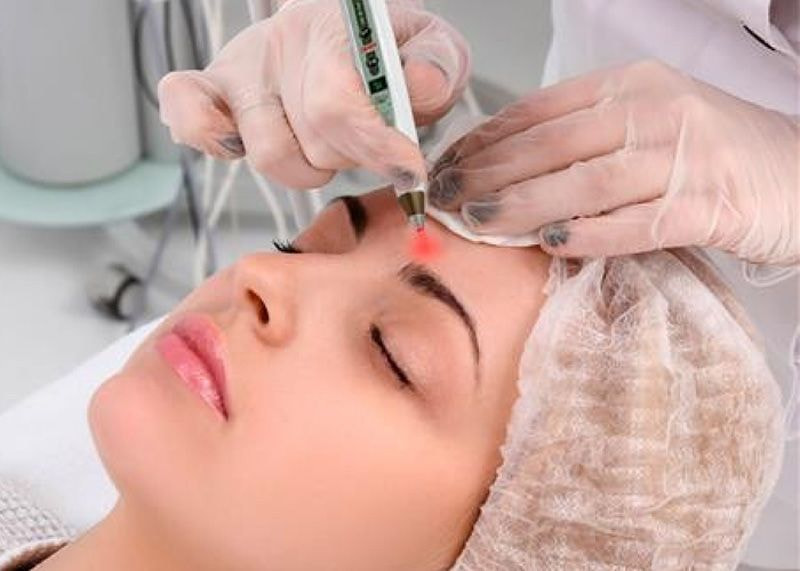 aplicação de laserterapia em rosto de paciente mulher