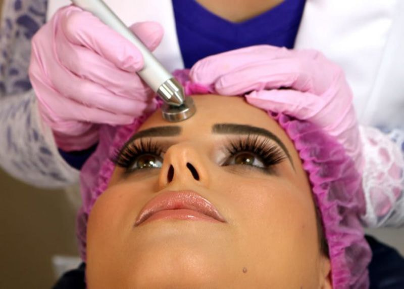 aplicação de peeling em rosto de paciente mulher