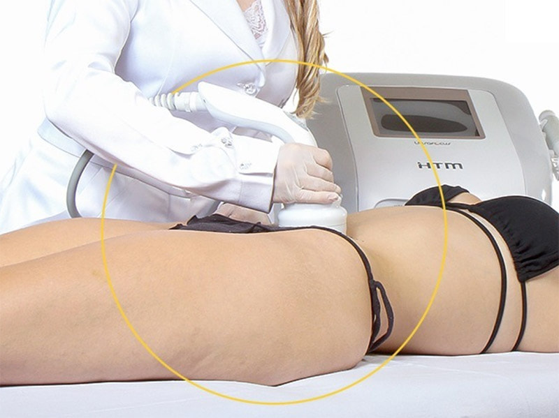 foto de profissional esteta fazendo ultrassom estético em paciente